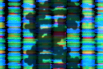 Image by Peter Artymiuk via the Wellcome Collection. Depicts the shadow of a DNA double helix, on a background that shows the fluorescent banding of the sequencing output from an automated DNA sequencing machine.